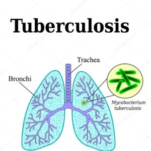 Greenlife Tuberculosis Cure